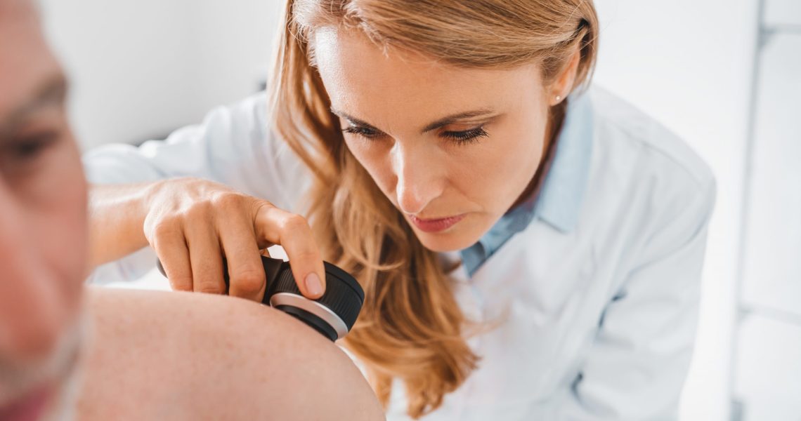 Doctor,Dermatologist,Examines,Skin,Of,Patient.,Dermatoscopy,,Prevention,Of,Melanoma,